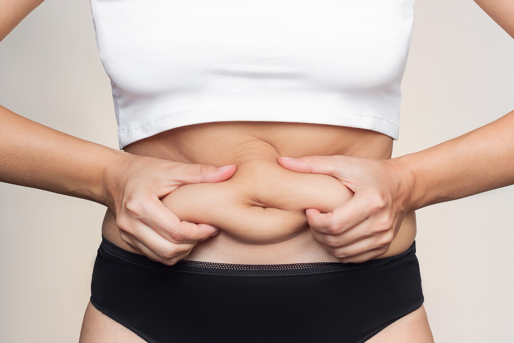Woman showing belly fat, and how you can learn to lose your belly fat using a comprehensive approach
